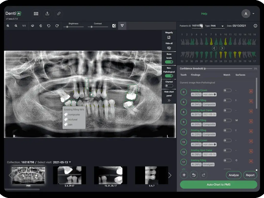 Denti.AI Screenshot
